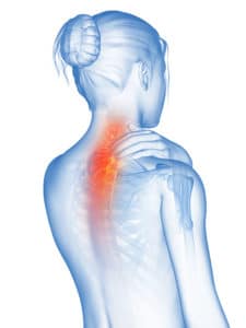 medical 3d illustration - woman having a painful neck